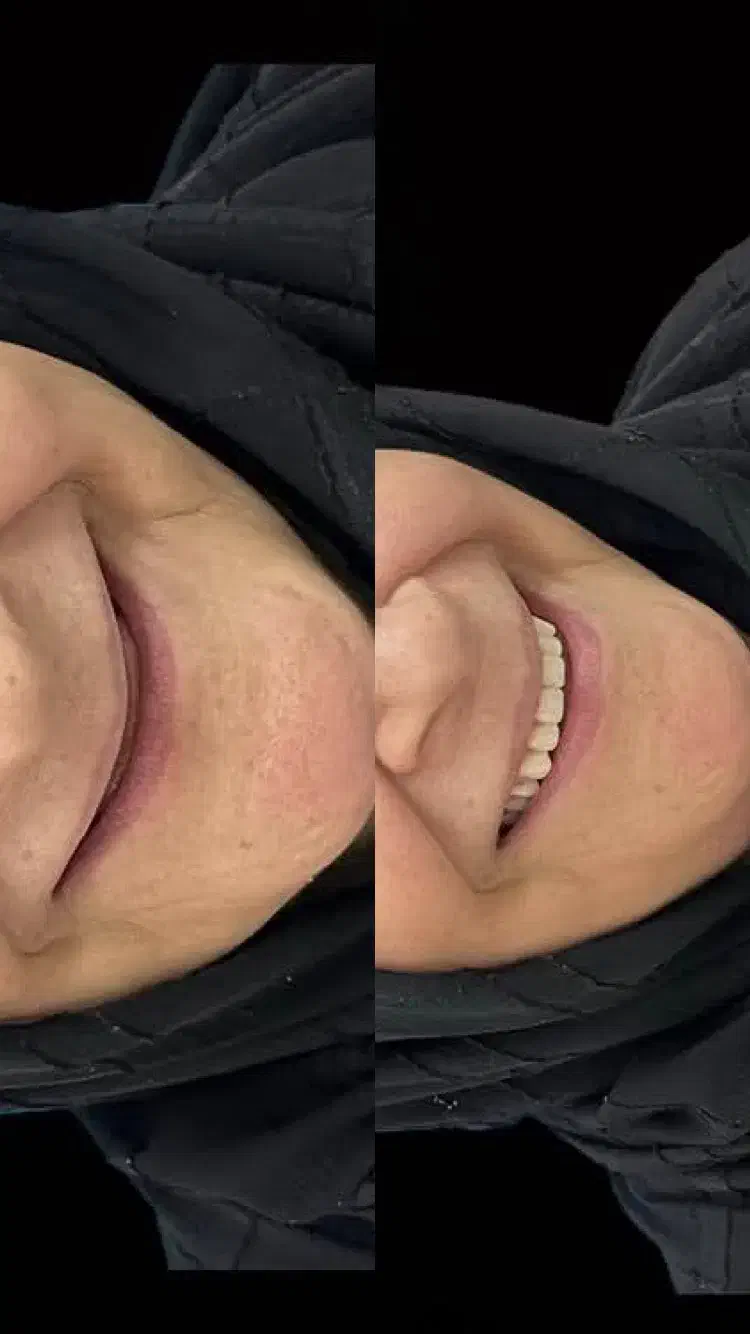 دندان مصنوعی با نظارت دکتر متخصص با بهترین هزینه|پزشکی|یزد, |دیوار