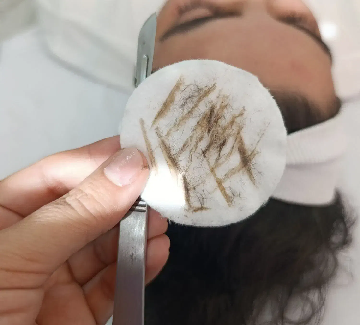 فیشال و خدمات پوستی در کلینیک|خدمات آرایشگری و زیبایی|اسلامآباد غرب, |دیوار