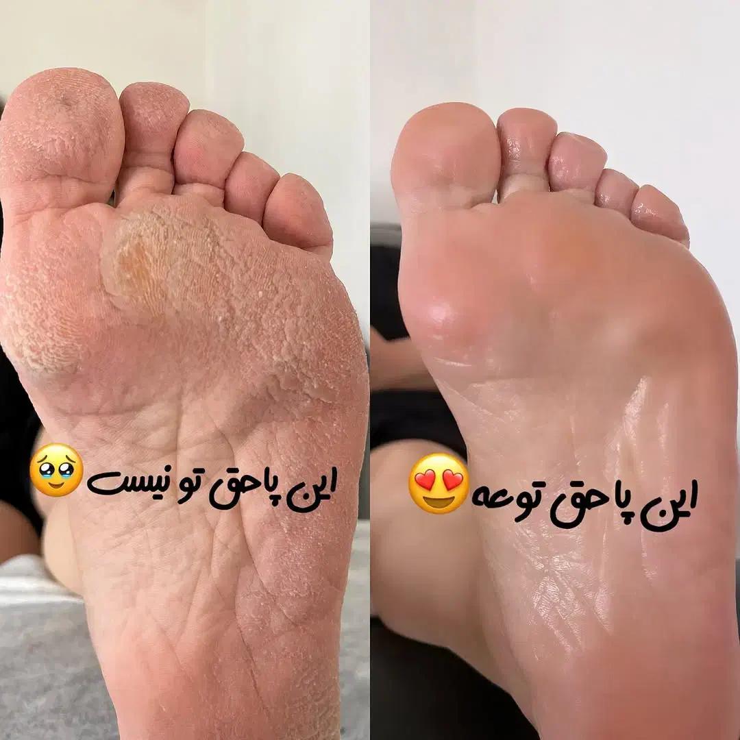 پدیکور درمانی مانیکور پارافین دست وپا|خدمات آرایشگری و زیبایی|کارون, |دیوار