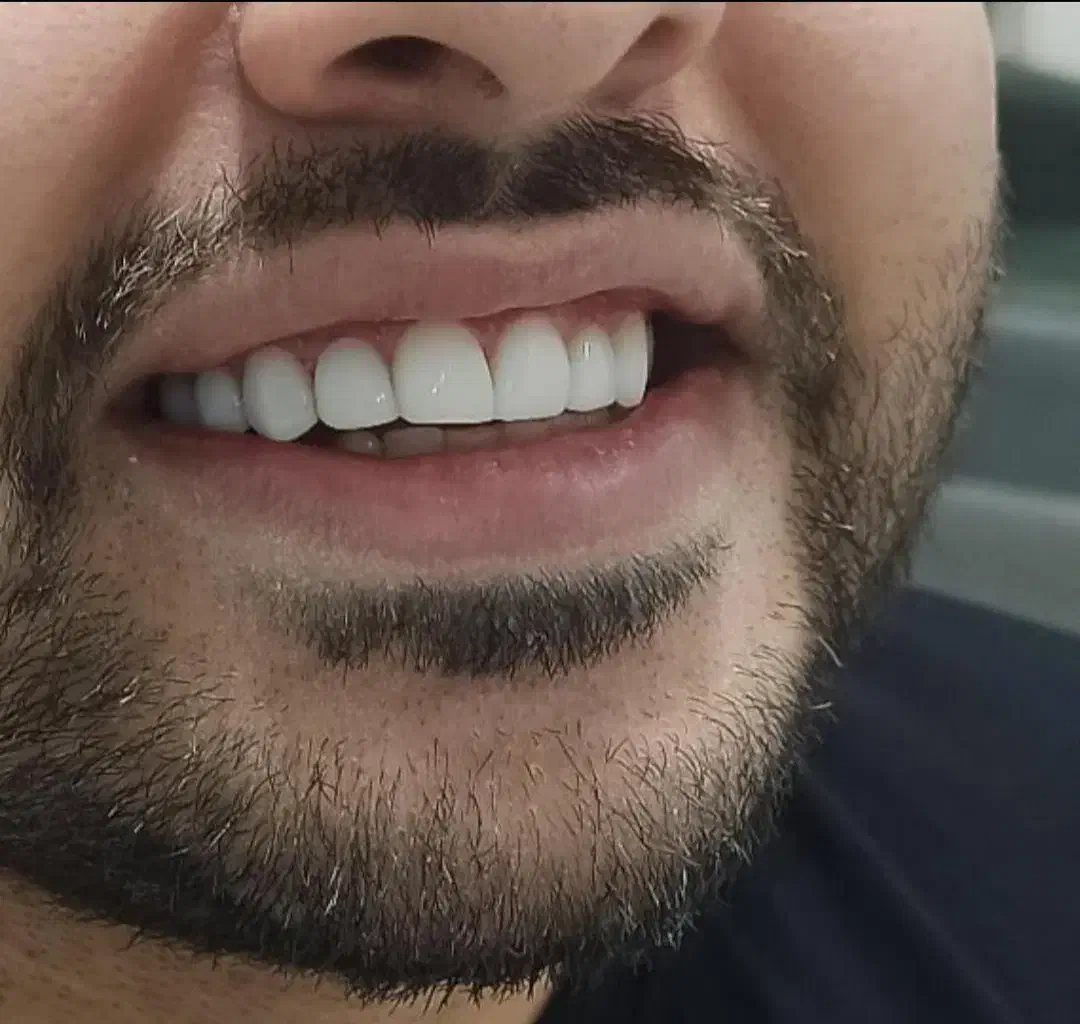 دندانپزشکی دندون طلا|خدمات آرایشگری و زیبایی|دورود, |دیوار