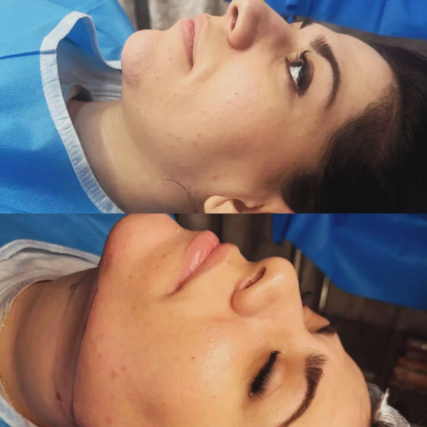 ساکشن غبغب|خدمات آرایشگری و زیبایی|پرند, فاز ۲|دیوار