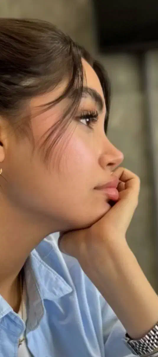 10 میلیون تخفیف عمل جراحی بینی بدون تامپون،لیفت|خدمات آرایشگری و زیبایی|فردیس, طالقانی|دیوار