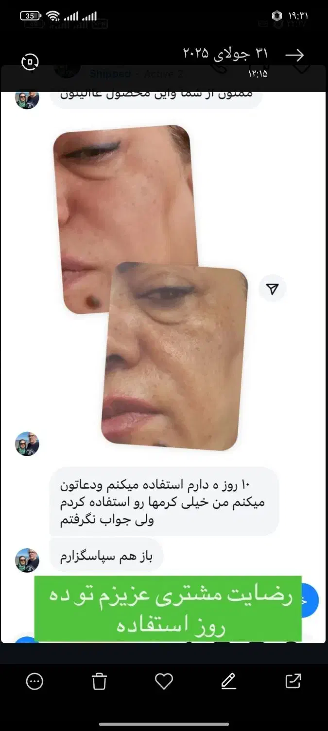 پک روشنایی ورفع تیرگی صورت وبدن|حراج|زرند, |دیوار