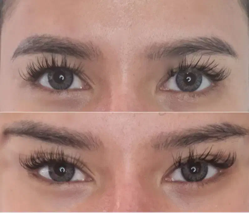 بوتاکس پیشانی،بوتاکس چشم گربه ای، لیزر موهای زائد|خدمات آرایشگری و زیبایی|خسروشاه, |دیوار