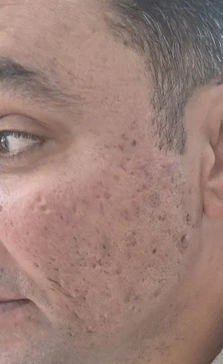 فیشیال کار جهت همکاری|استخدام درمانی، زیبایی، بهداشتی|کرمانشاه, |دیوار