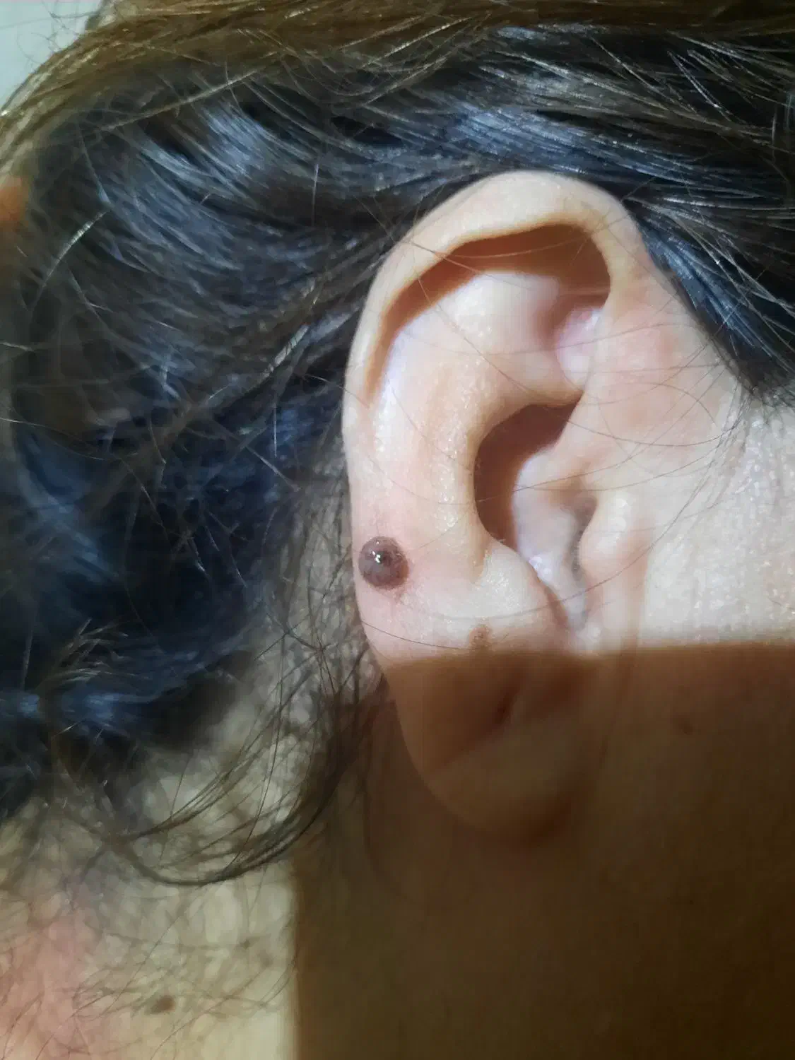 حذف خال ،زگیل فقط با قطره|خدمات آرایشگری و زیبایی|سبزوار, غرب نیروگاه|دیوار