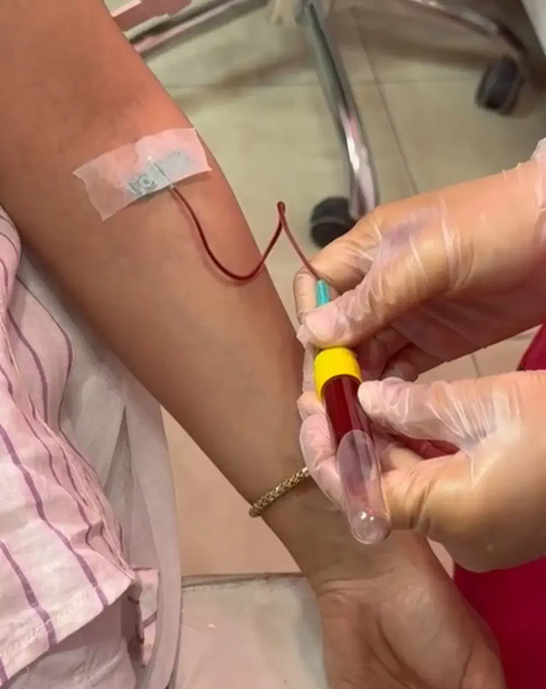 جشنواره تخفیف پی آر پی(PRP)/مزونیدلینگ مو و صورت|خدمات آرایشگری و زیبایی|اصفهان, باغ زرشک|دیوار