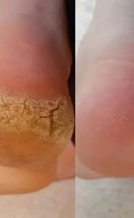 پدیکور و پاکسازی|خدمات آرایشگری و زیبایی|تربت‌حیدریه, شهید قرنی|دیوار