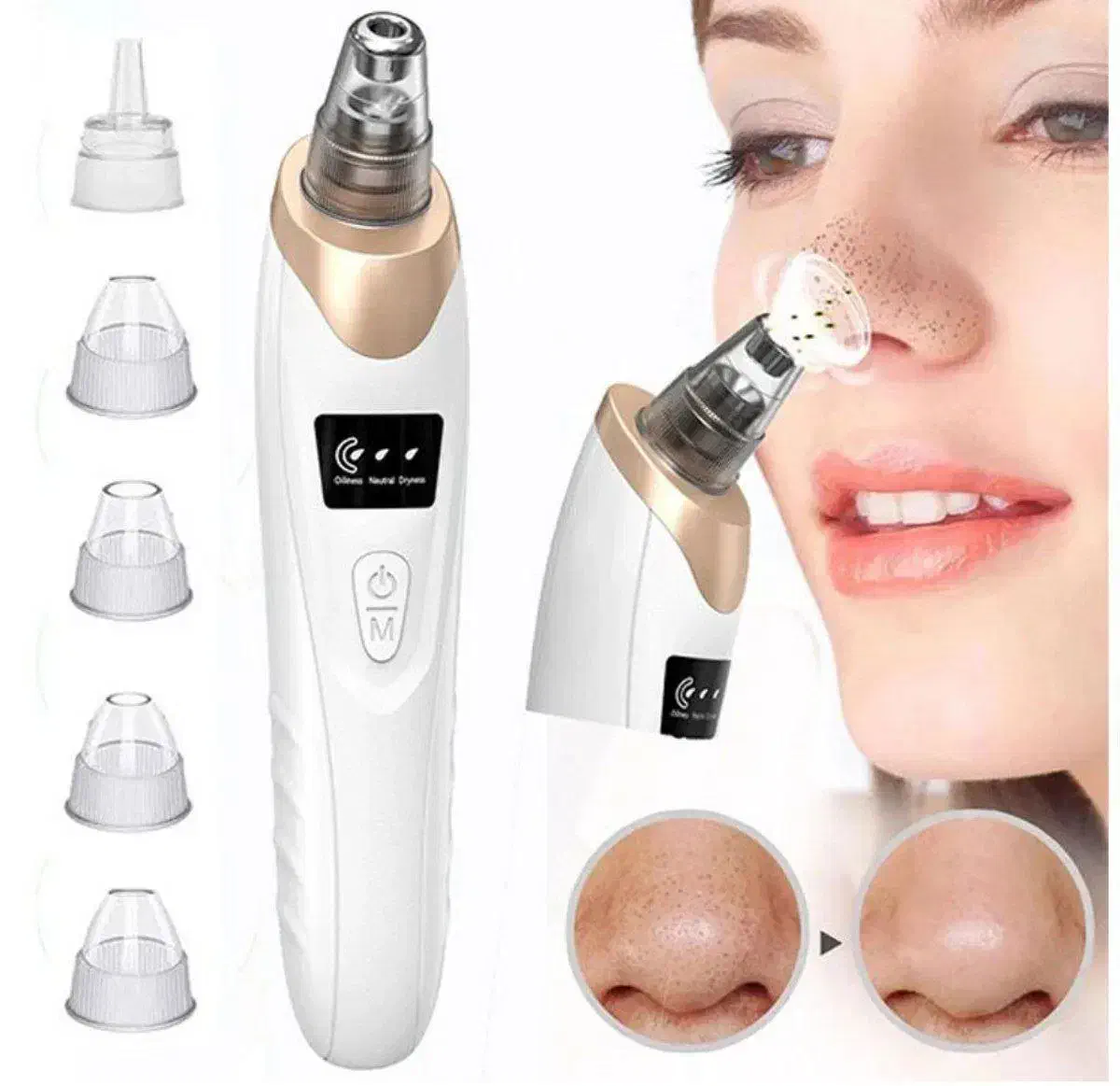 میکرودرم دستگاه جوانساز و پاکسازی پوست|آرایشی، بهداشتی، درمانی|رشت, پاستوریزه|دیوار