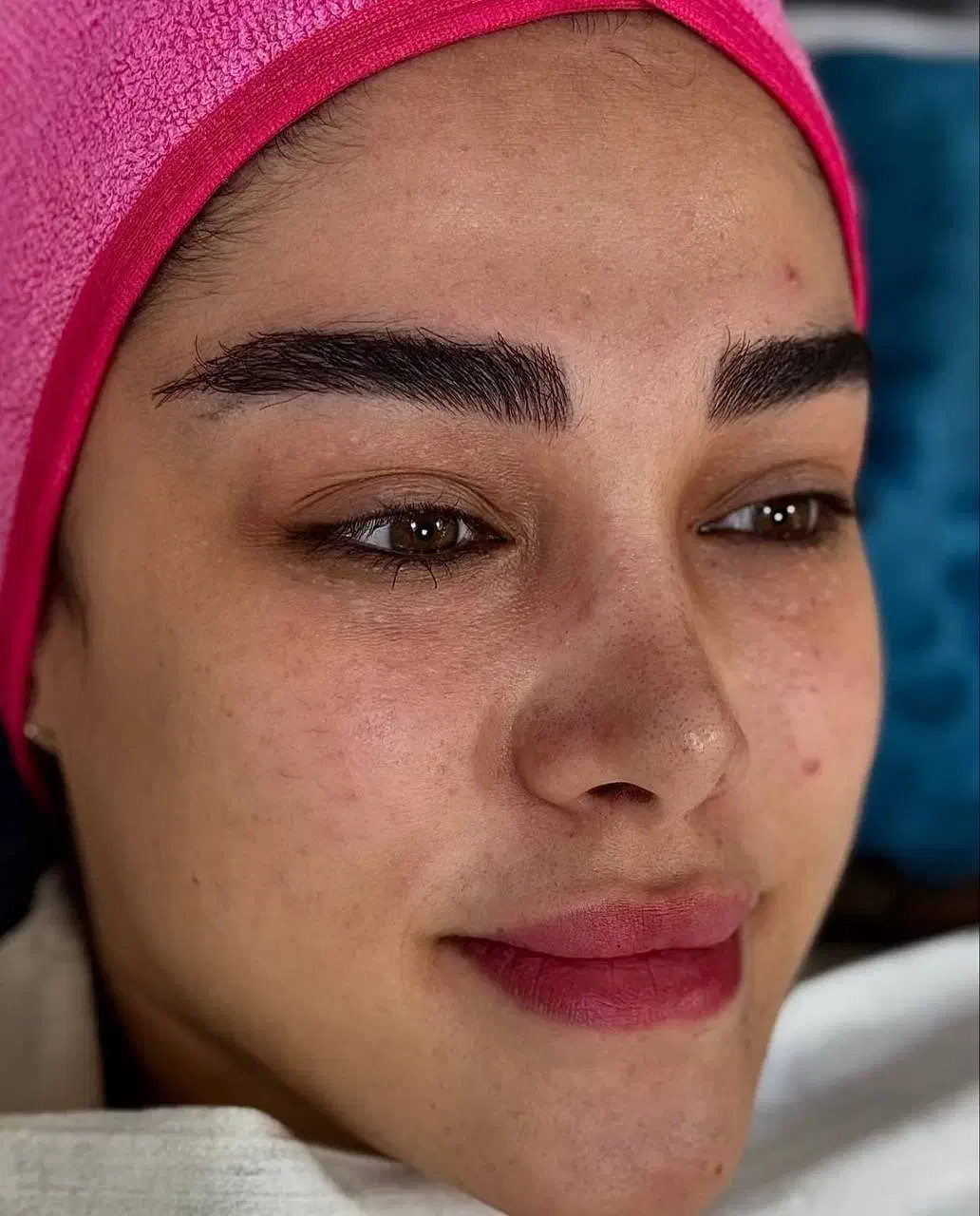 فیشال تخصصی زیر نظر پزشک|خدمات آرایشگری و زیبایی|مسجد سلیمان, |دیوار