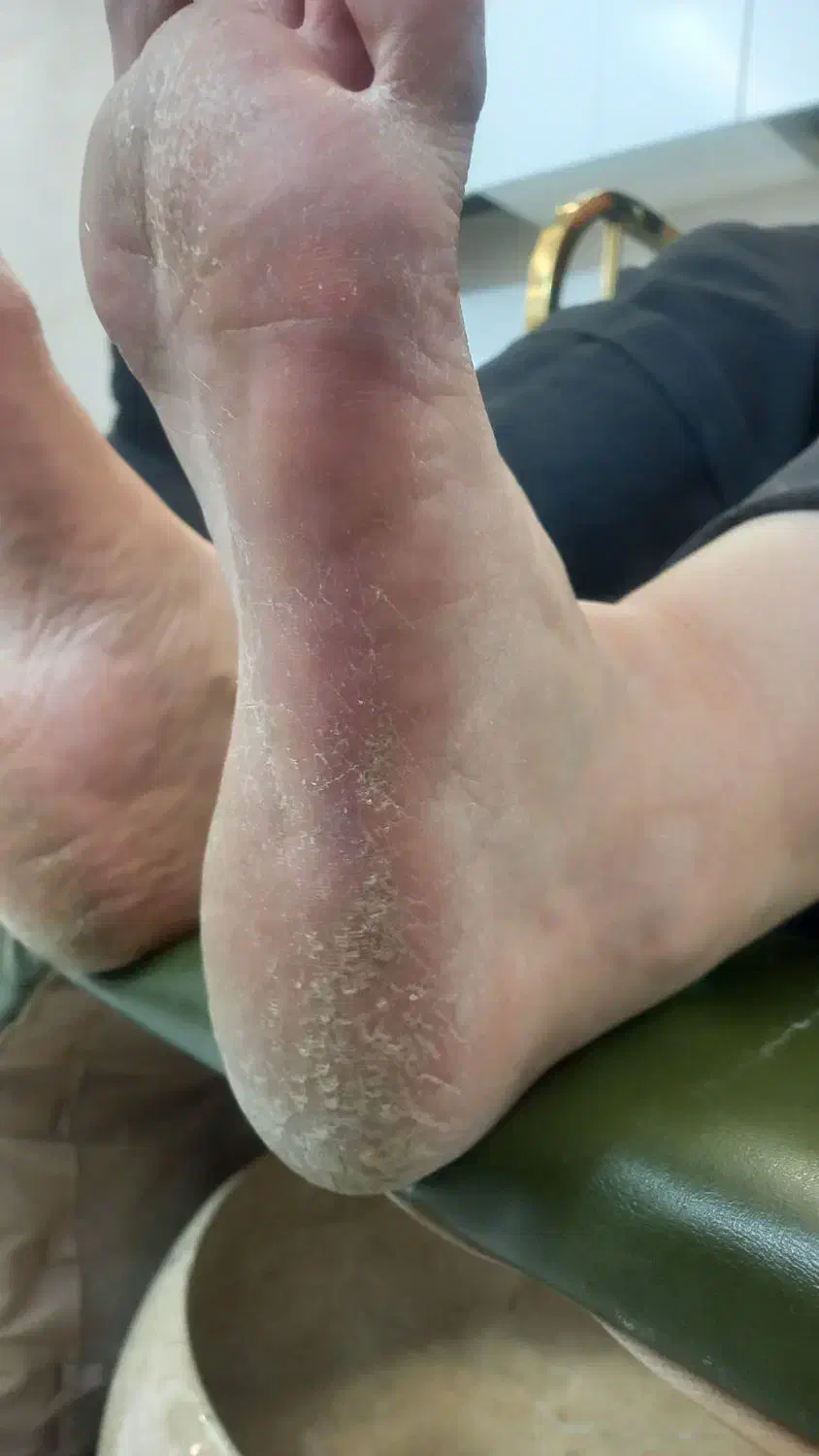 پدیکور و کفسابی (مخصوص بانوان)|خدمات آرایشگری و زیبایی|قزوین, |دیوار