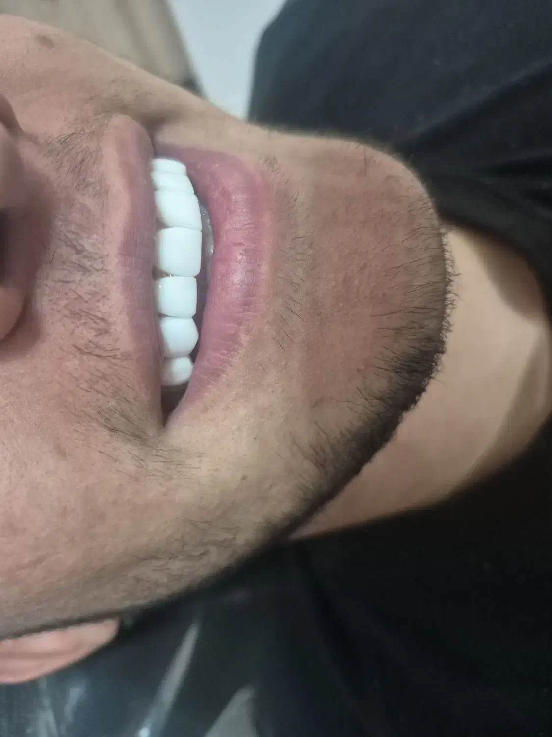 kampozit|خدمات آرایشگری و زیبایی|فولادشهر, C5|دیوار