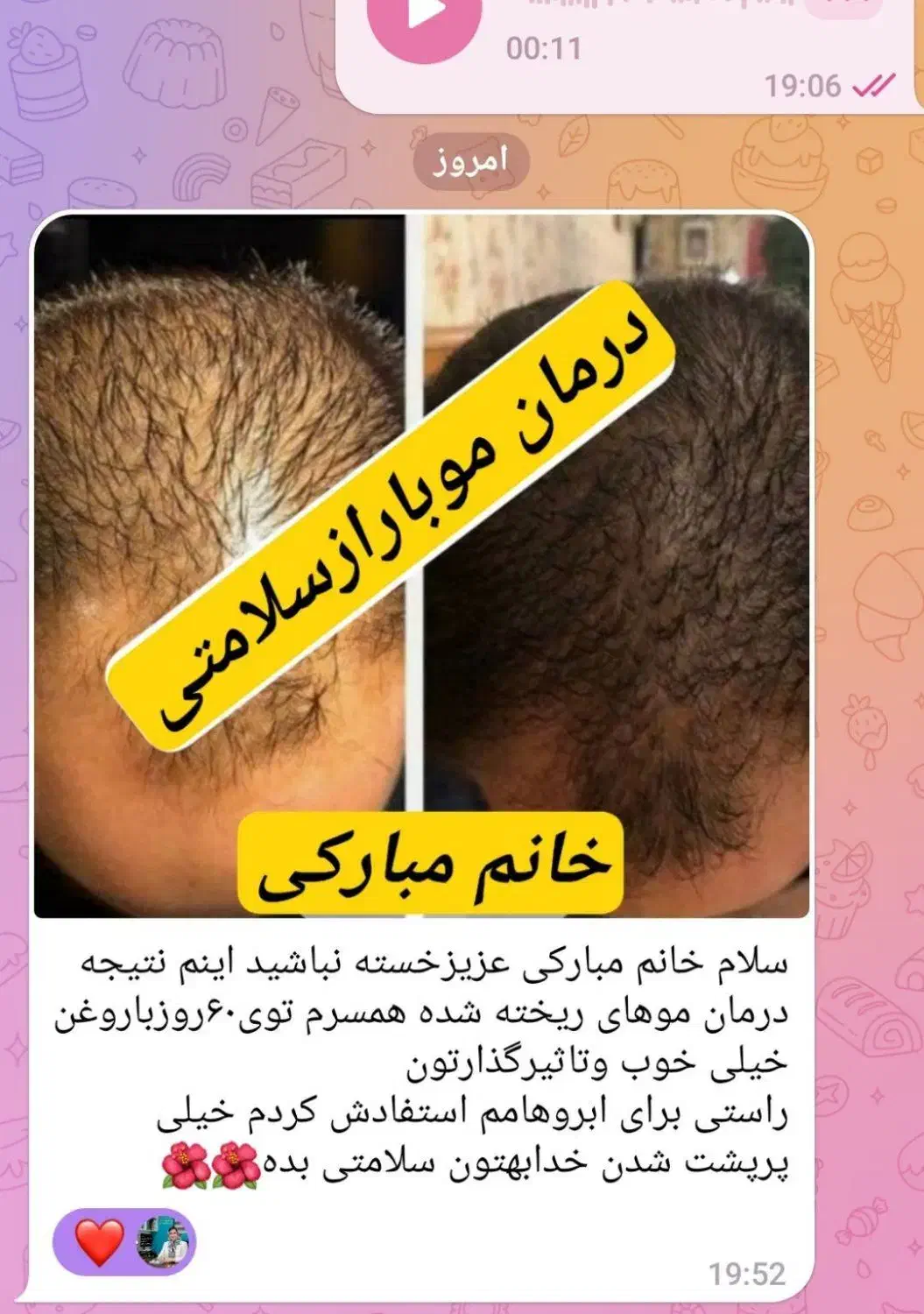 پوست و مو|آرایشی، بهداشتی، درمانی|آستانه اشرفیه, |دیوار