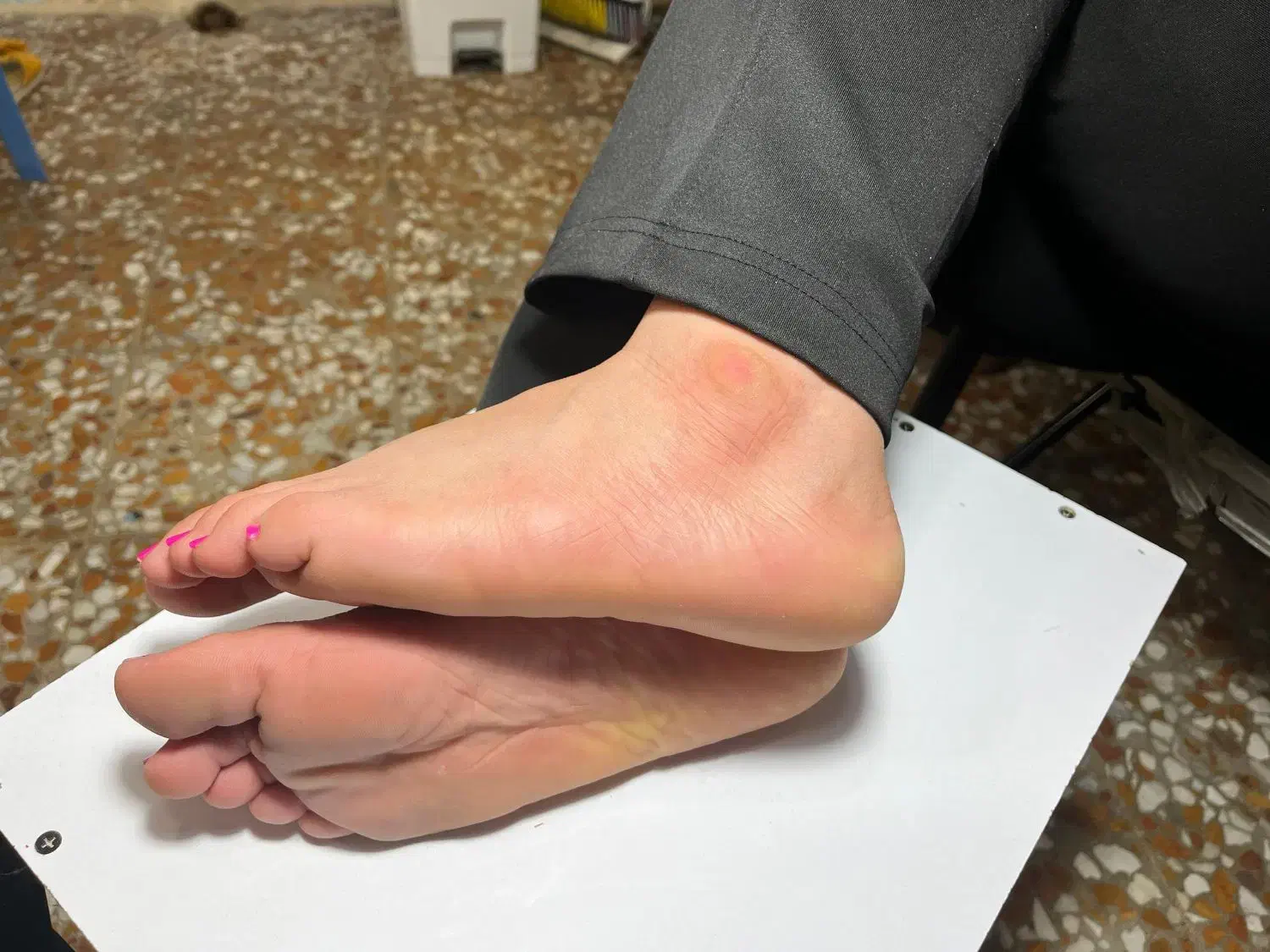 پدیکور|خدمات آرایشگری و زیبایی|ایذه, |دیوار