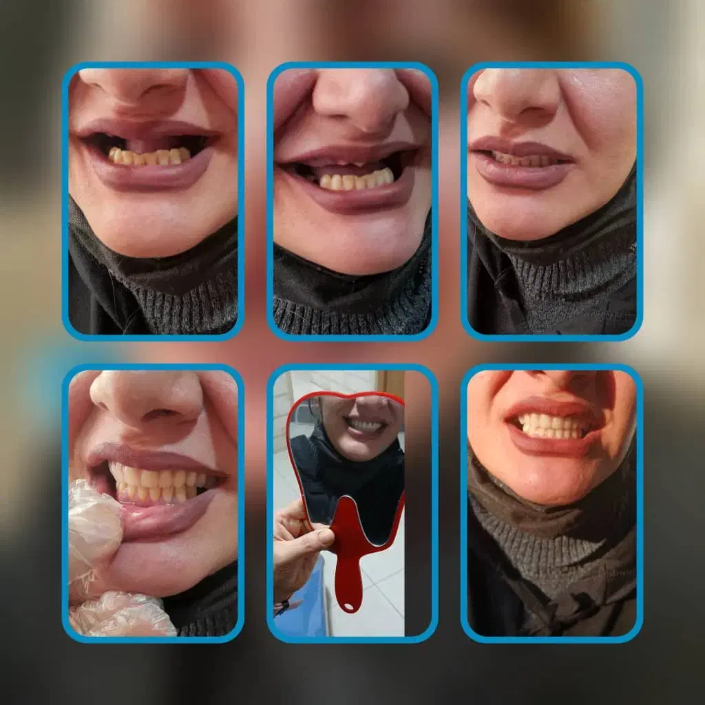 دندانپزشکی،دندانسازی|خدمات آرایشگری و زیبایی|دشتابی, |دیوار