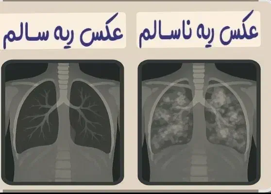 مشاوره طب سنتی برای مشکلات تنفسی|خدمات آرایشگری و زیبایی|رفسنجان, |دیوار