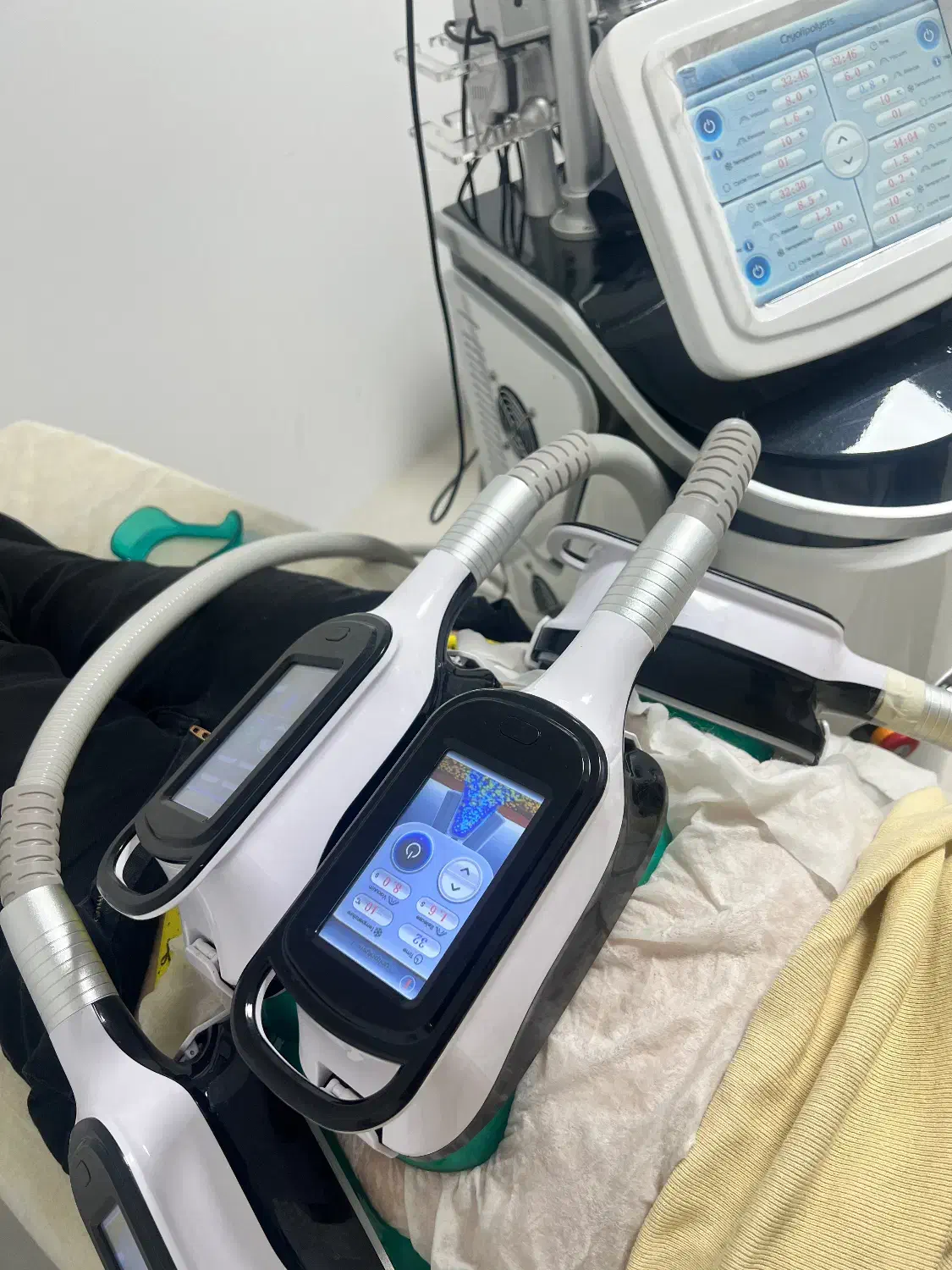 لیزر موهای زائد،دستگاه لاغری|خدمات آرایشگری و زیبایی|ارومیه, |دیوار