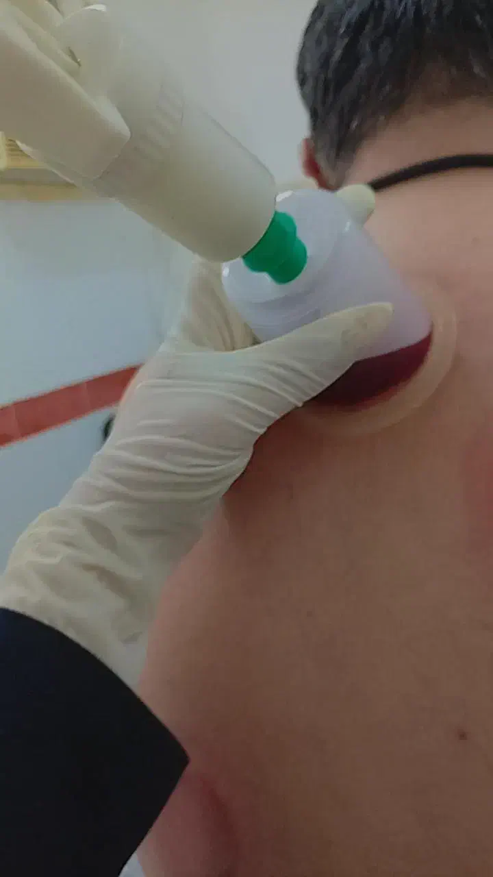 آموزش حجامت توسط پرستارخانوم|خدمات آموزشی|برازجان, |دیوار