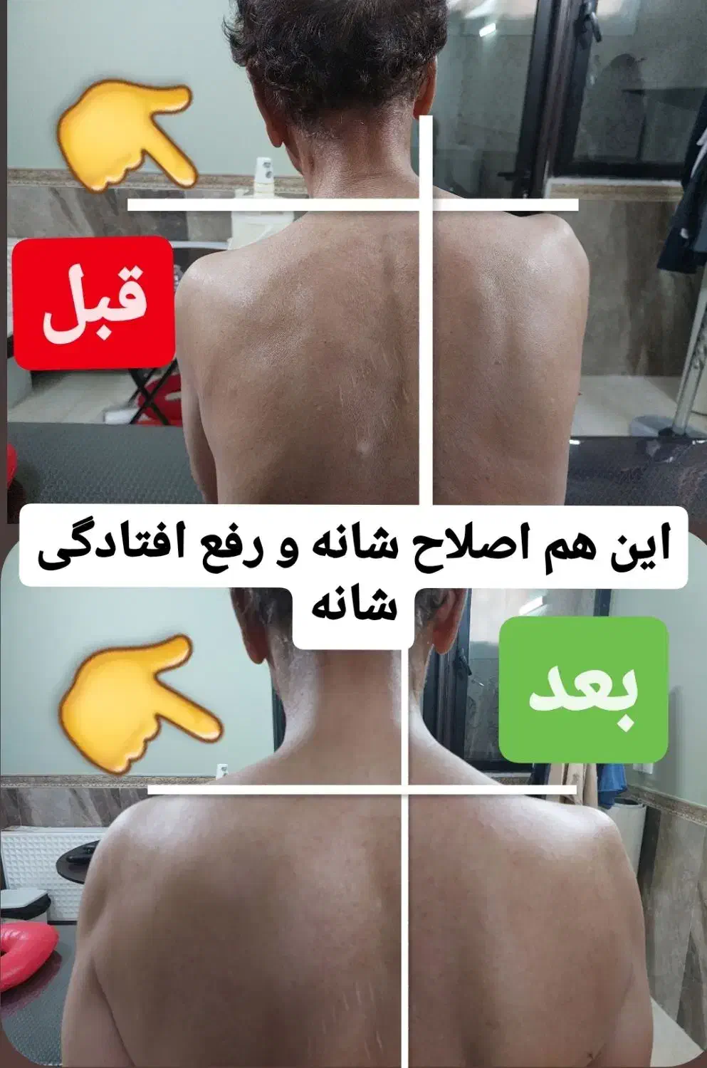 رگگیری.اصلاحی.زالودرمانی.حجامت.اصلاحی|خدمات آرایشگری و زیبایی|کاشان, دشت چال|دیوار