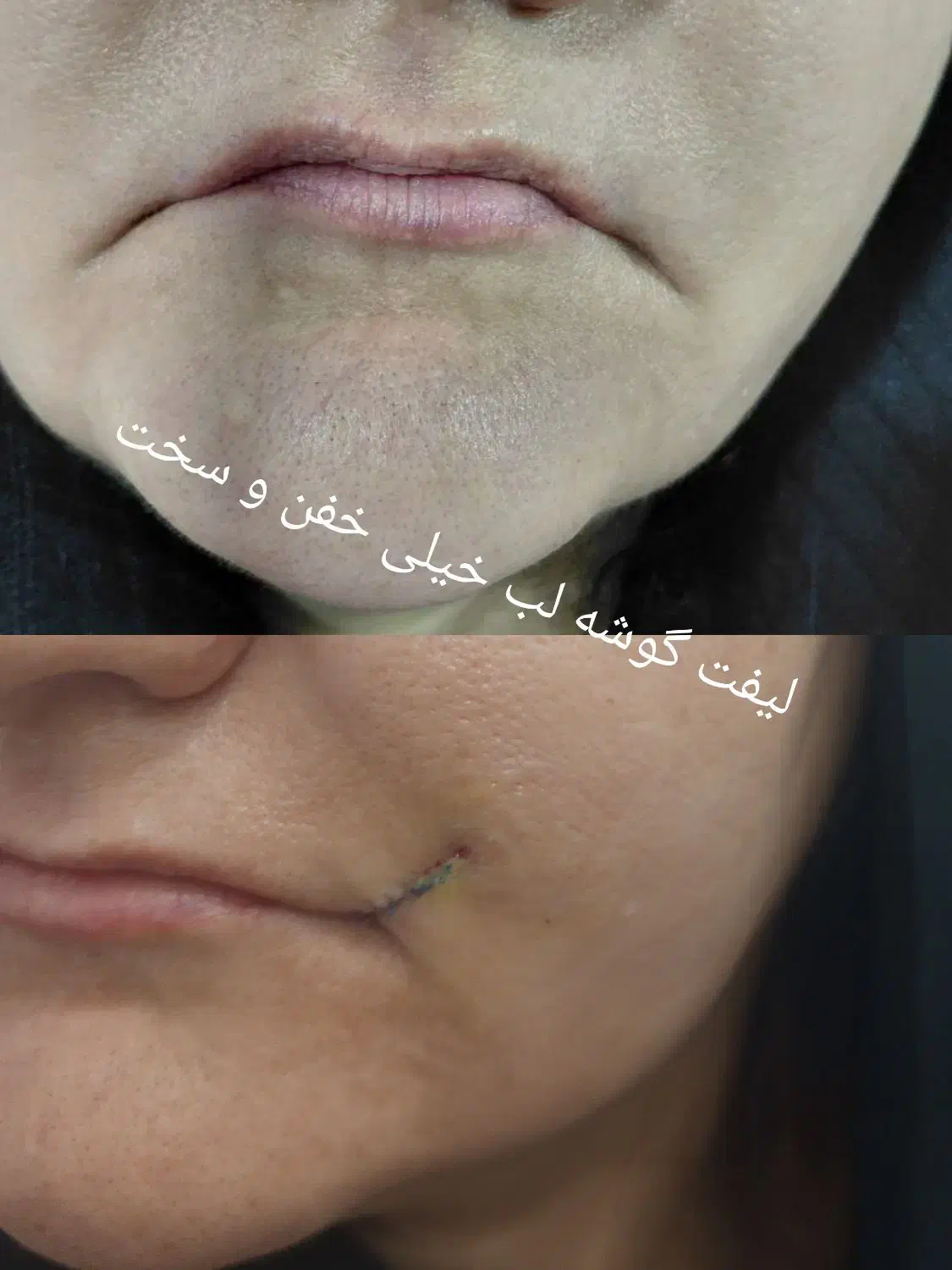 تخفیف ویژه خدمات زیبایی|خدمات آرایشگری و زیبایی|کوهدشت, |دیوار