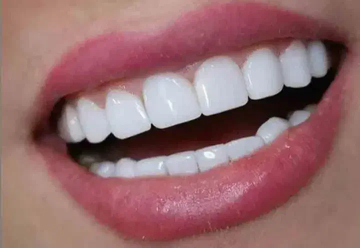 مژده به اهالی محترم گلباف در مورد دندانپزشکی|خدمات آرایشگری و زیبایی|گلباف, |دیوار