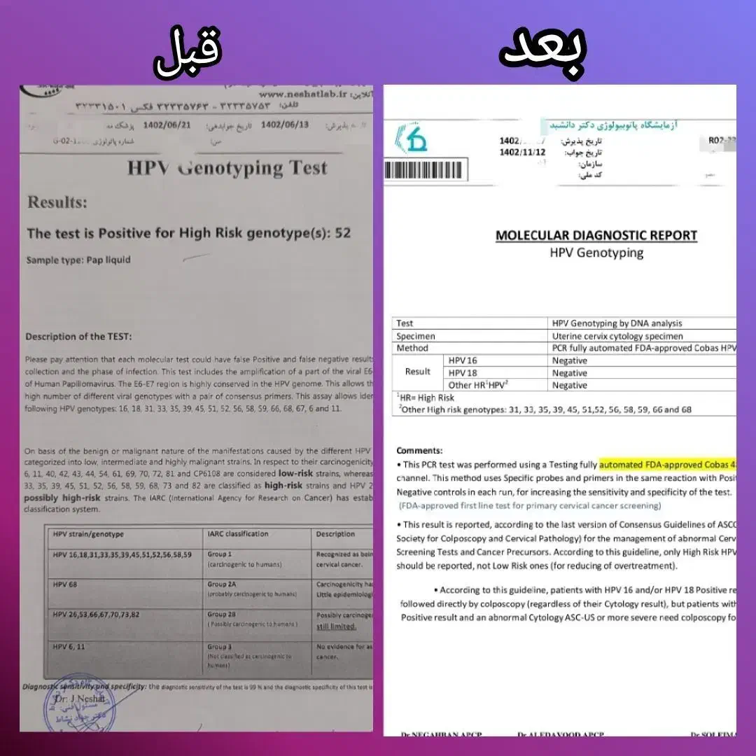 پوستت صورت زیبا کن|آرایشی، بهداشتی، درمانی|خرمآباد, |دیوار