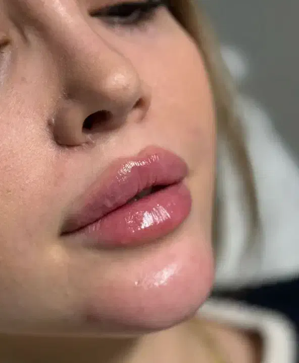 کیلینک زیبایی پاستور تخصصی ترین کیلینک زنجان|خدمات آرایشگری و زیبایی|زنجان, |دیوار