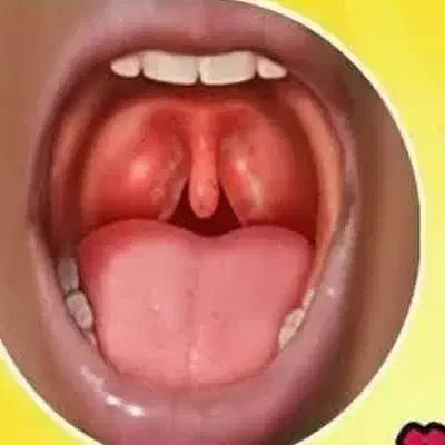 بهبود خلط پشت حلق|آرایشی، بهداشتی، درمانی|گنبد کاووس, |دیوار