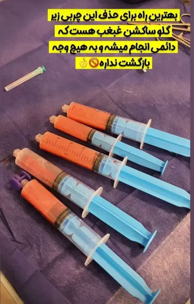 ساکشن شکم پهلو ۱۰ میلیون تومان ، پزشک ۲۰ سال تجربه|خدمات آرایشگری و زیبایی|مشهد, هفت تیر (نه دره)|دیوار