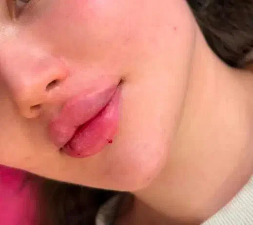 ژل و بوتاکس/ ژل لب/کانتورینگ عربی/روسی|خدمات آرایشگری و زیبایی|فردیس, فردیس|دیوار