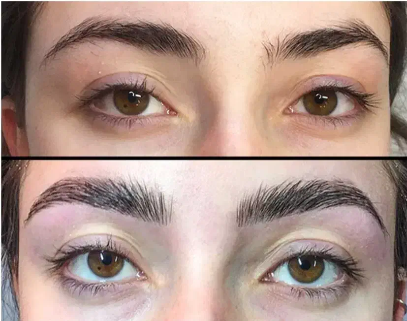 لیفت ابرو600|خدمات آرایشگری و زیبایی|زابل, |دیوار