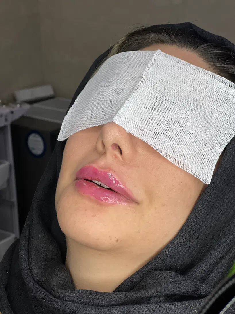 ۵۰٪ تخفیف خدمات زیبایی ،بوتاکس ،فیلرلب|خدمات زیبایی و سلامت|تهران, آهنگ|دیوار