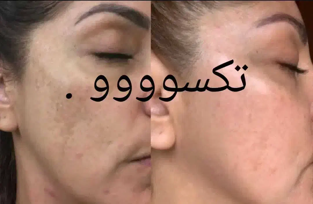 پک روشن کننده صورت و بدن|آرایشی، بهداشتی، درمانی|اهواز, امانیه|دیوار