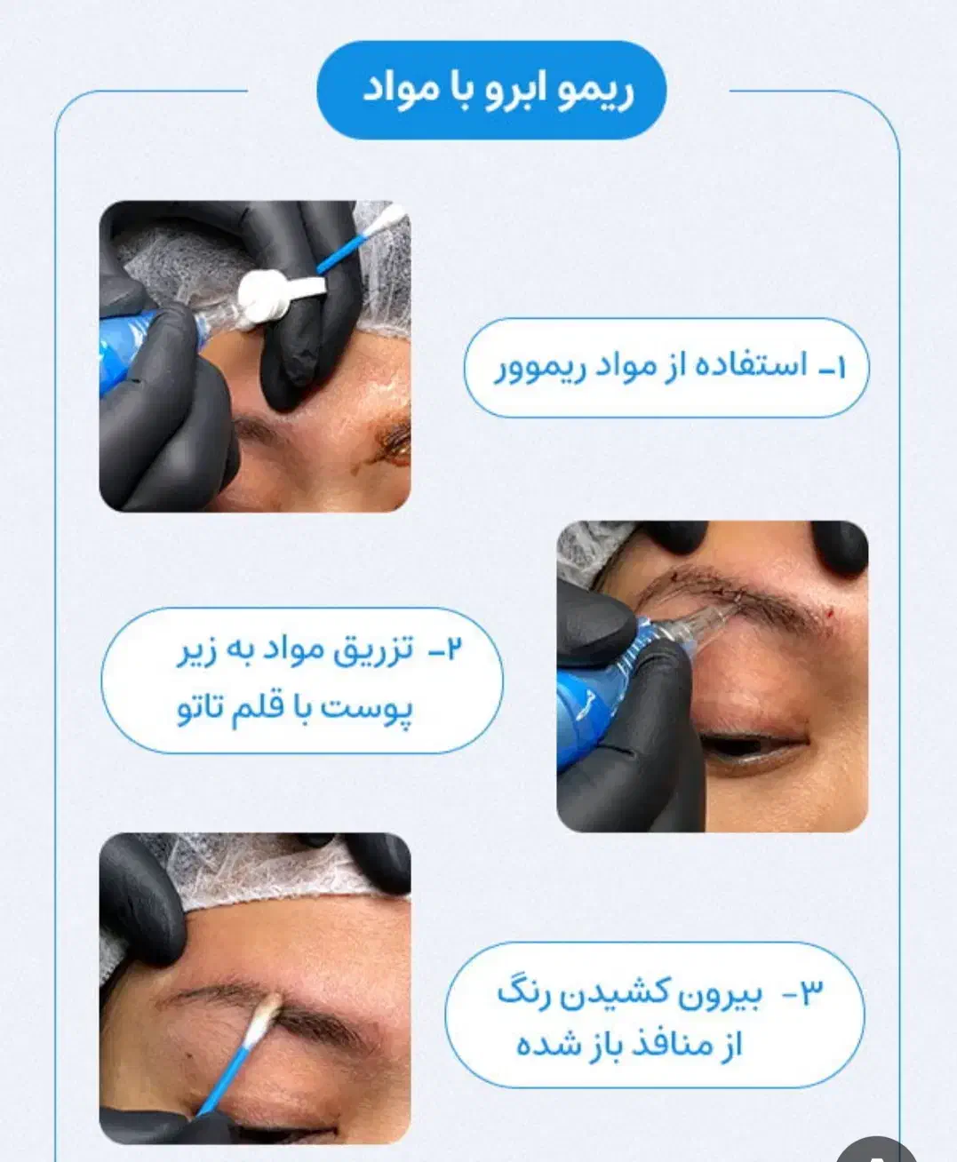 ریمو|فعالیت داوطلبانه|کوهدشت, |دیوار