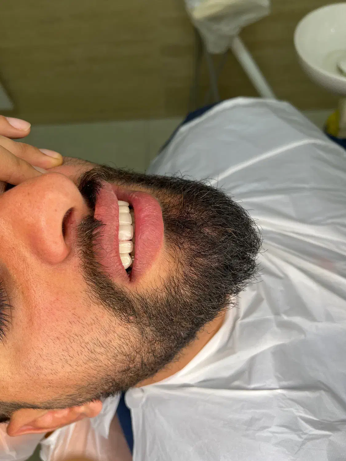 دستیار دندانپزشک|استخدام درمانی، زیبایی، بهداشتی|آمل, |دیوار