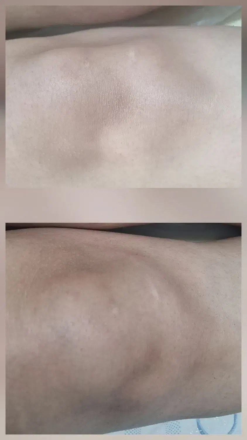 روشن شدن نواحی تیره بدن|خدمات آرایشگری و زیبایی|مشهد, الهیه|دیوار