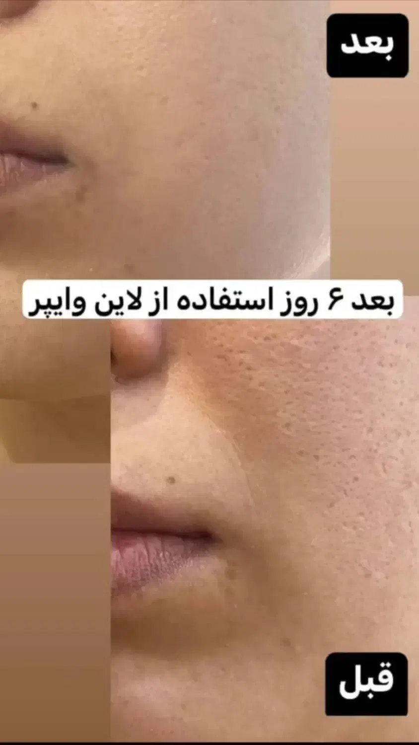 جوانسازی|آرایشی، بهداشتی، درمانی|شیراز, ابیوردی|دیوار