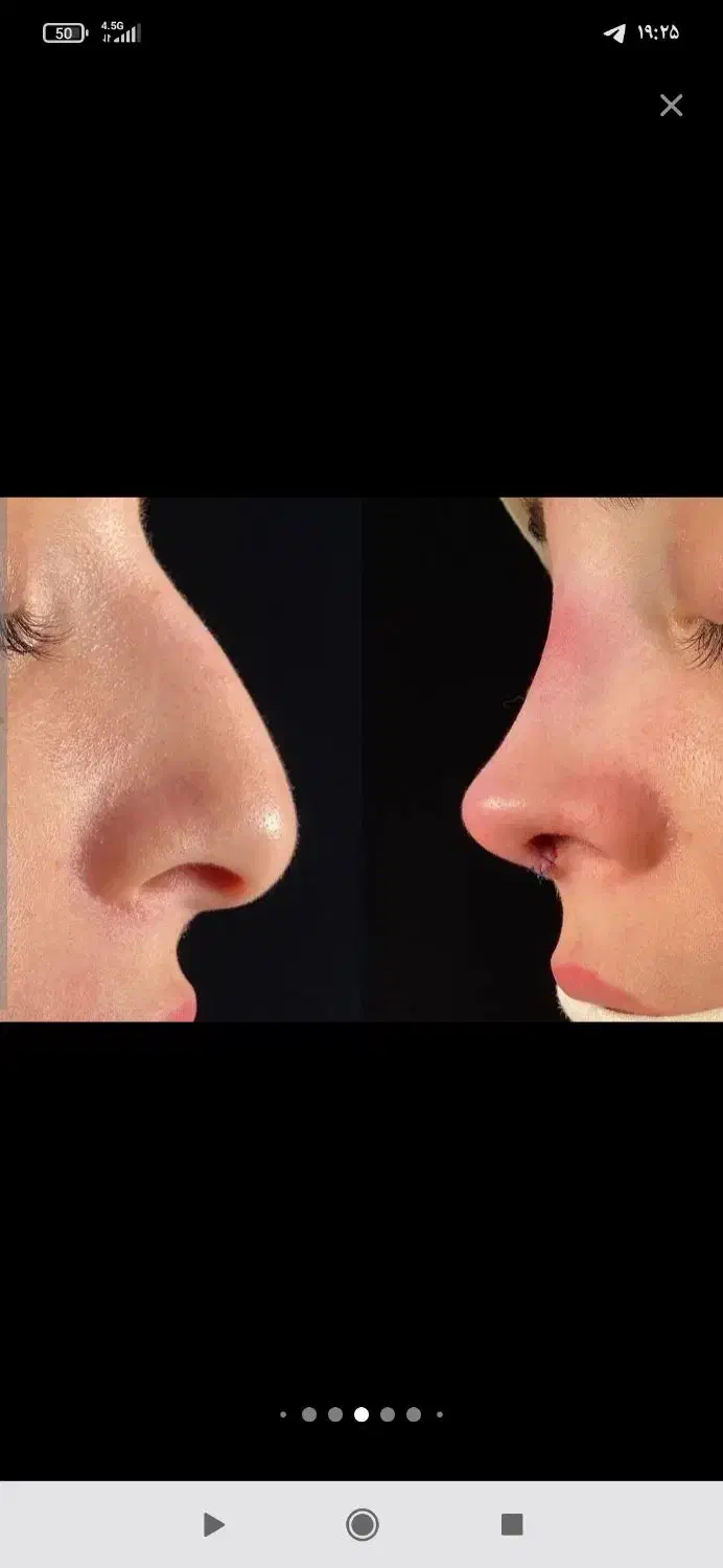 جشنواره لیپو .مامو .بینی بلفارو کل صورت .چک صیادی|خدمات آرایشگری و زیبایی|تهران, دروس|دیوار