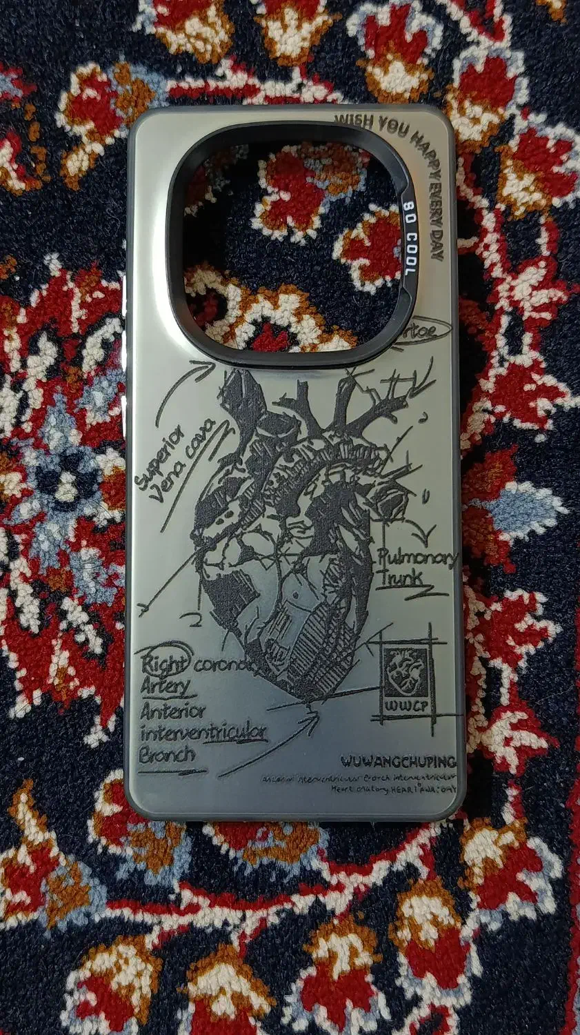 گارد گوشی نوت چهارده پرو فورجی|لوازم جانبی موبایل و تبلت|فولادشهر, B2|دیوار