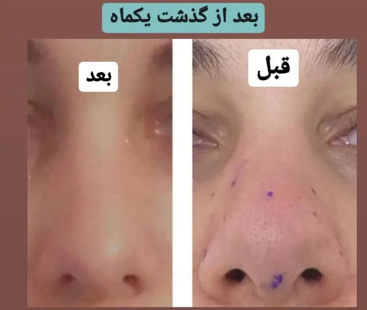 آموزش و خدمات ژل و بوتاکس|خدمات آرایشگری و زیبایی|زابل, |دیوار