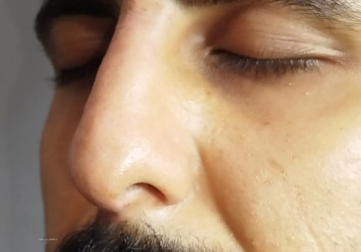 اصلاح فرم بینی بدون جراحی|خدمات آرایشگری و زیبایی|رشت, بلوار گیلان|دیوار