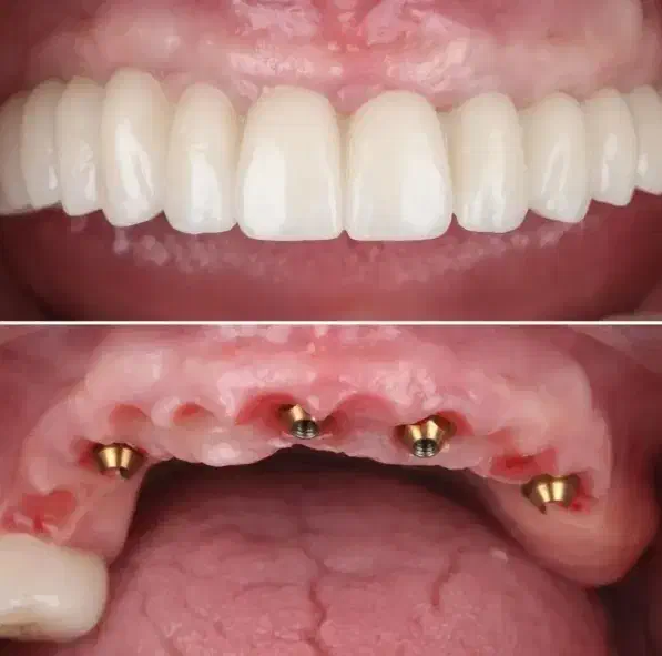 جشنواره کلیه خدمات دندانپزشکی با اقساط ۱۵ ماهه|خدمات آرایشگری و زیبایی|تبریز, |دیوار