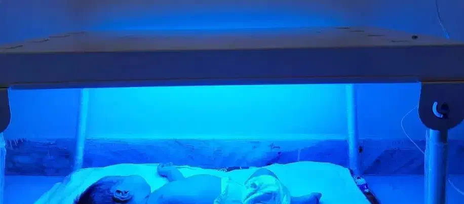 اجاره روزانه دستگاه فتوتراپی درمان زردی نوزاد|پزشکی|پیشوا, |دیوار