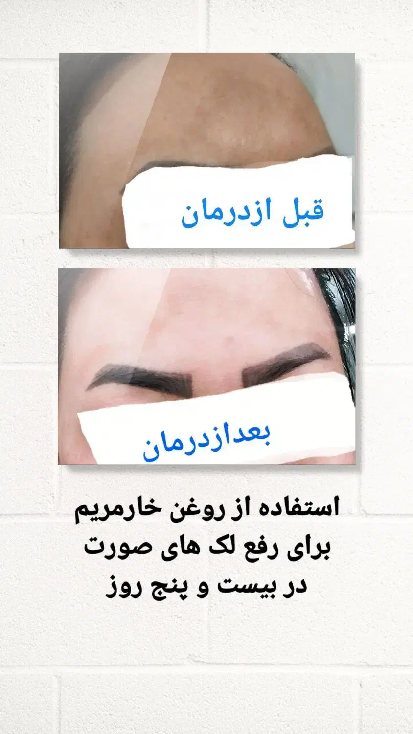 مشاور طب سنتی|خدمات آرایشگری و زیبایی|زابل, |دیوار