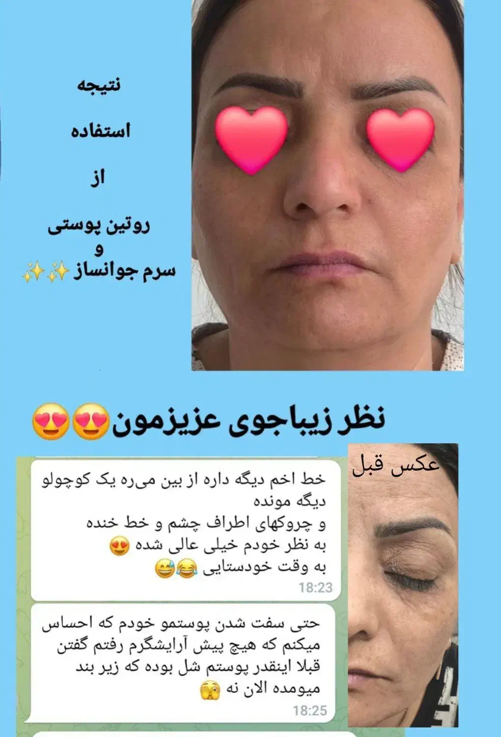 جوش لک و چین چروک امانت بریده|آرایشی، بهداشتی، درمانی|اهواز, آریاشهر|دیوار