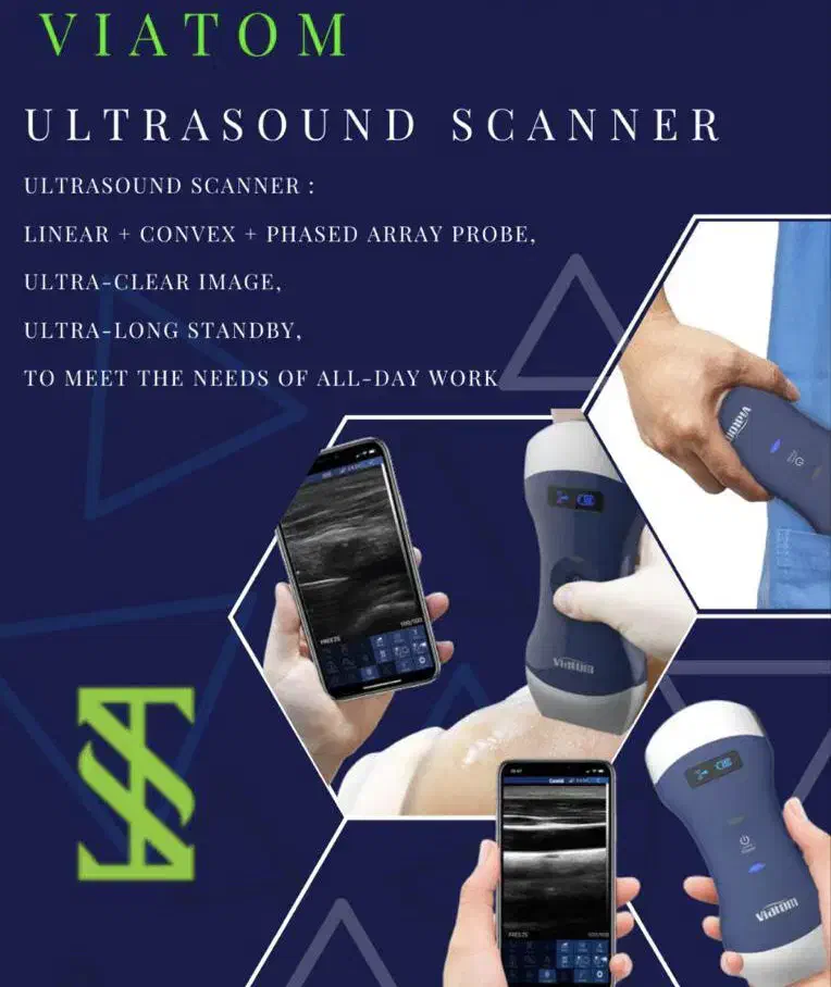 سونوگرافی وایرلس کمپانی Viatom|پزشکی|تهران, پونک|دیوار