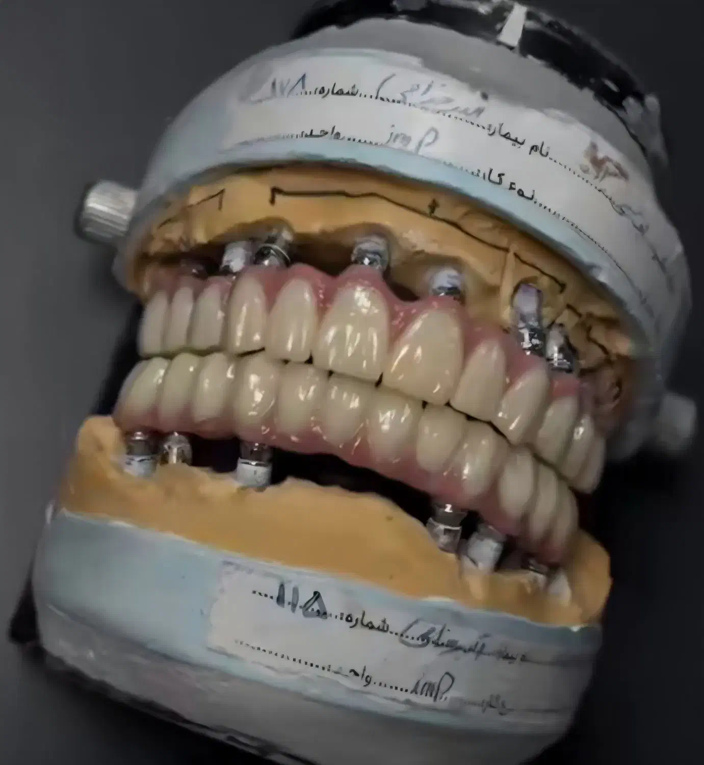 تکنسین دندانسازی ثابت|استخدام درمانی، زیبایی، بهداشتی|مشهد, هفت تیر (آب و برق)|دیوار