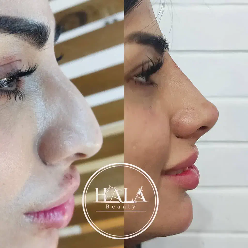 خدمات زیبایی صورت|خدمات آرایشگری و زیبایی|آبادان, |دیوار