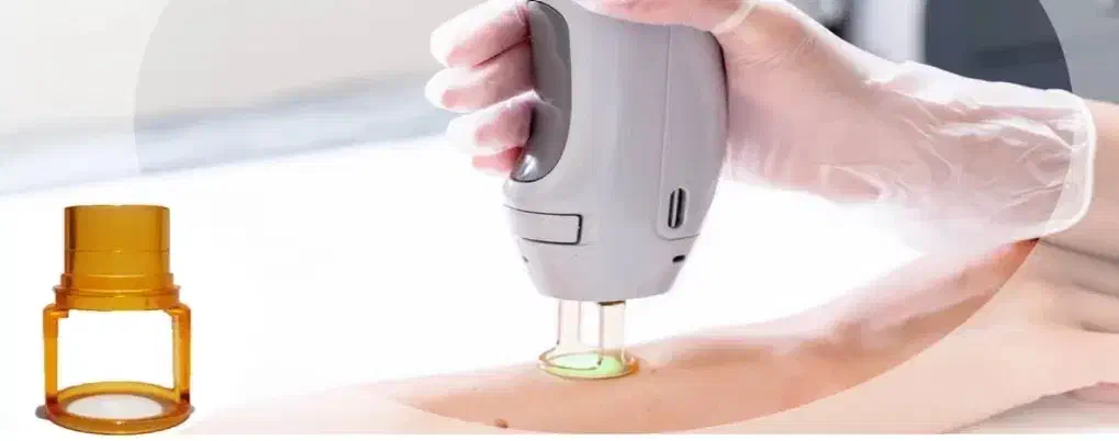 لیزر موهای زاید فیبرنوری|آرایشی، بهداشتی، درمانی|یاسوج, |دیوار