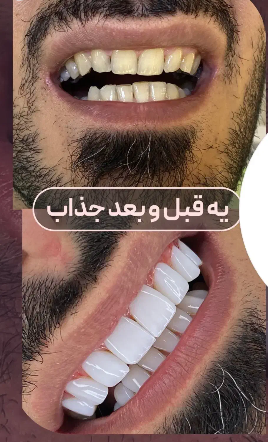 جشنواره کامپوزیت از ۵۹۰|خدمات آرایشگری و زیبایی|اهواز, کیانپارس |دیوار